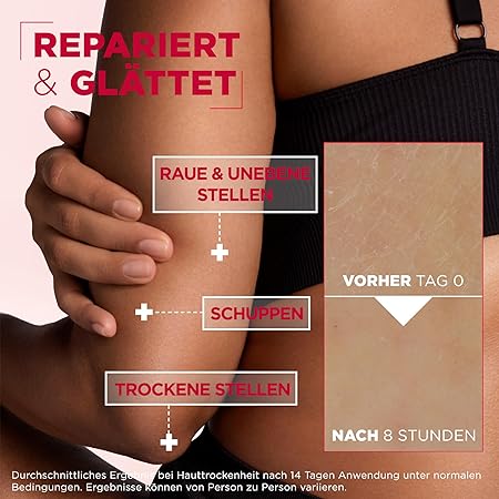 Mixa Creme für trockene und rissige Haut, Feuchtigkeitspflege für den Körper, Hände und Gesicht, Mit Urea und Niacinamide, Urea Cica Repair + Hauterneuernde Creme, 1 x 400 ml – Bild 7